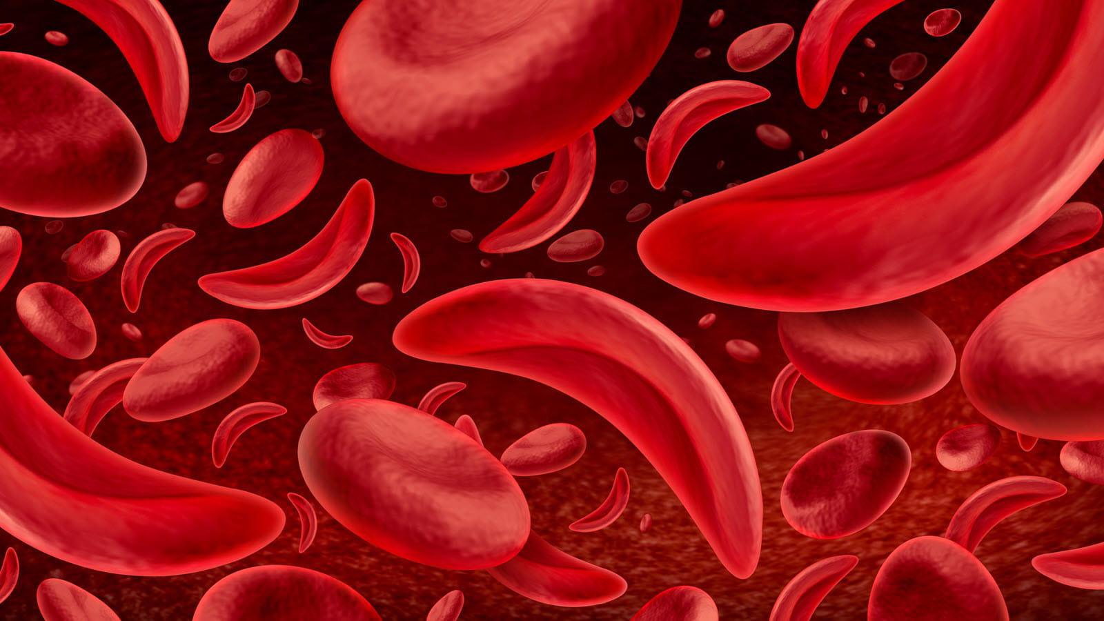 red sickle cells shown from different angles